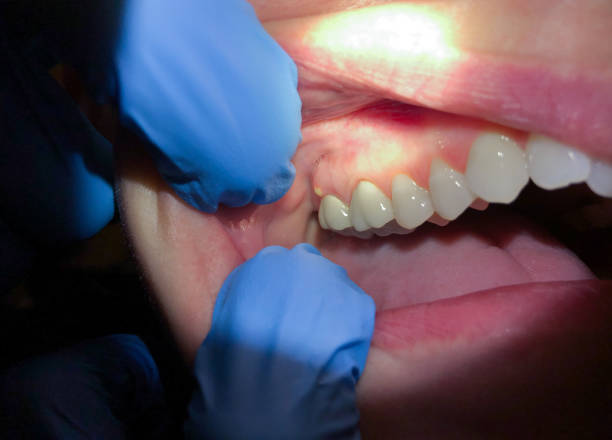 Best Emergency Root Canal Treatment in Kenilworth, PA