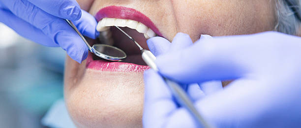 Best Emergency Dental Extractions in Kenilworth, PA